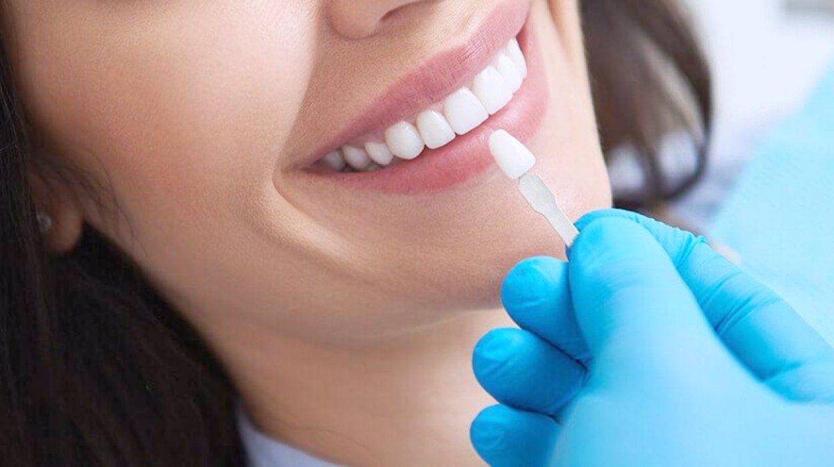 الأسنان.. مرآة دقيقة للصحة والشخصية
