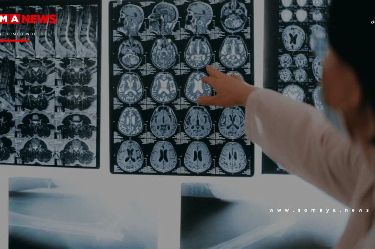7 علامات مبكرة تكشف ورماً في الدماغ