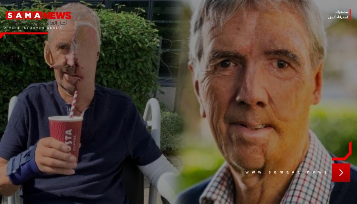 معجزة «NHS»: أول وجه مطبوع ثلاثي الأبعاد لرجل فقد ملامحه في حادثة!