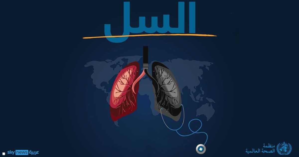 “الصحة العالمية تكشف أخطر الأمراض المعدية فتكًا حول العالم”