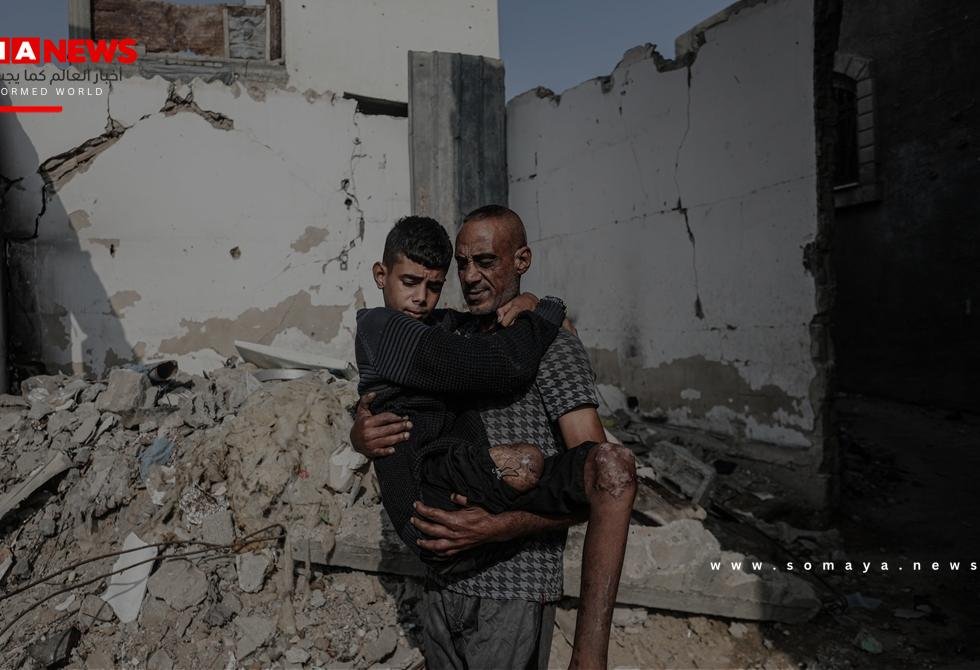 وزارة الصحة في غزة: 6000 حالة بتر في غزة بحاجة إلى برامج تأهيل عاجلة