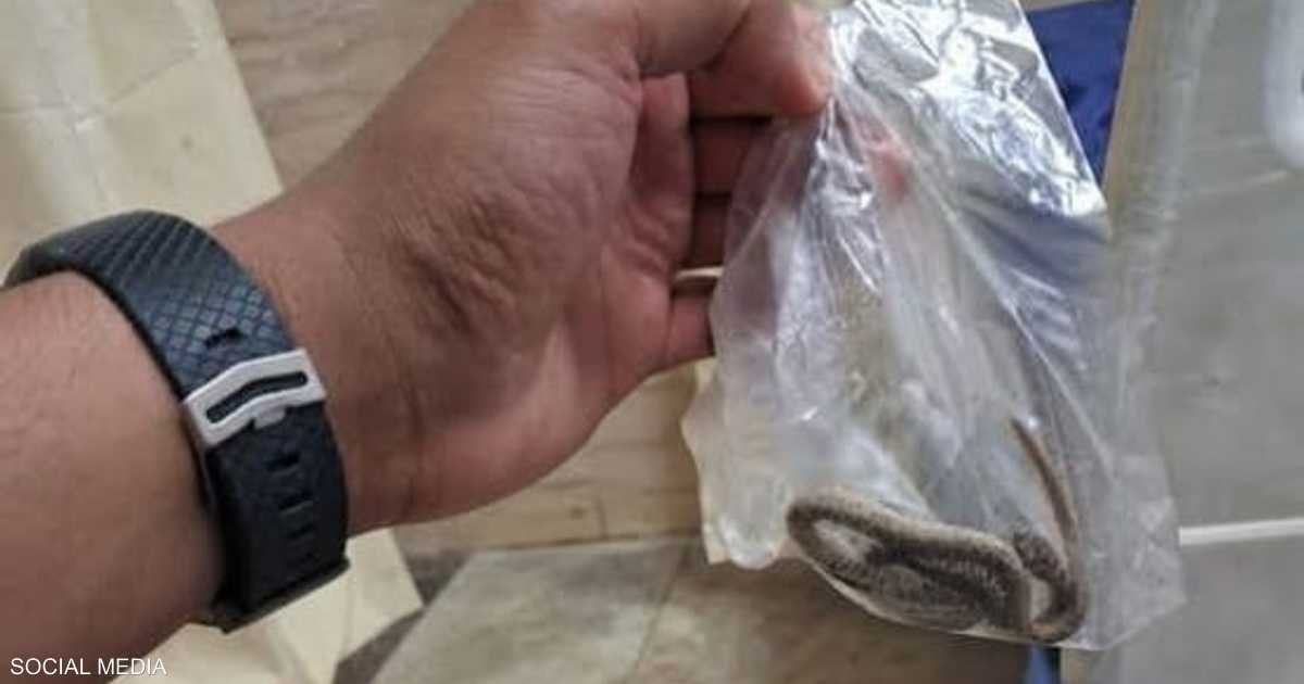 تصرف "غريب" من مصاب.. يفتح ملف لدغات الأفاعي في مصر