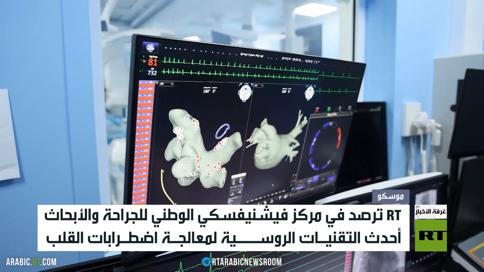 موسكو.. تقنيات متطورة لعلاج أمراض القلب