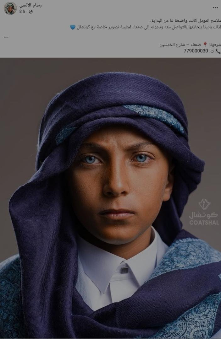 "رسام" اليمني يخطف أضواء الحرب بعينيه ويتحول لظاهرة على السوشيال ميديا