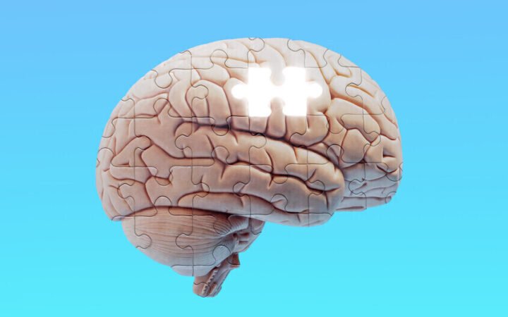 صورة تعبر عن ضعف بعض وظائف الدماغ