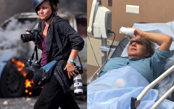 ضرب مبرح لصحفية أمريكية بعد اعتداء مستوطنين عليها في رام الله ودخولها المستشفى