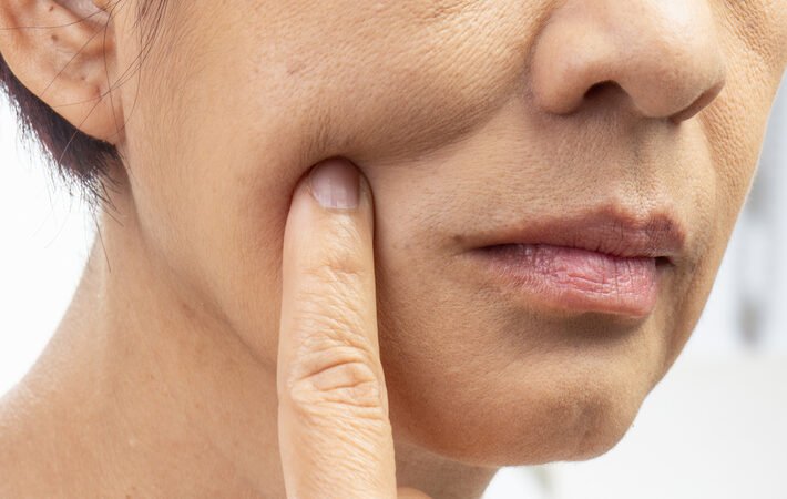 ضجة على "تيك توك" حول مستخلص نباتي صيني لعلاج "وجه أوزيمبيك".. ما حقيقته؟